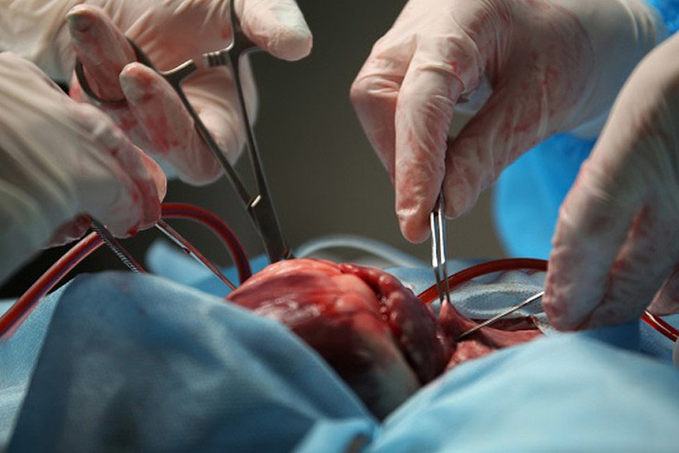 ONTV pide reactivación de programas de trasplante y donación de órganos de fallecidos